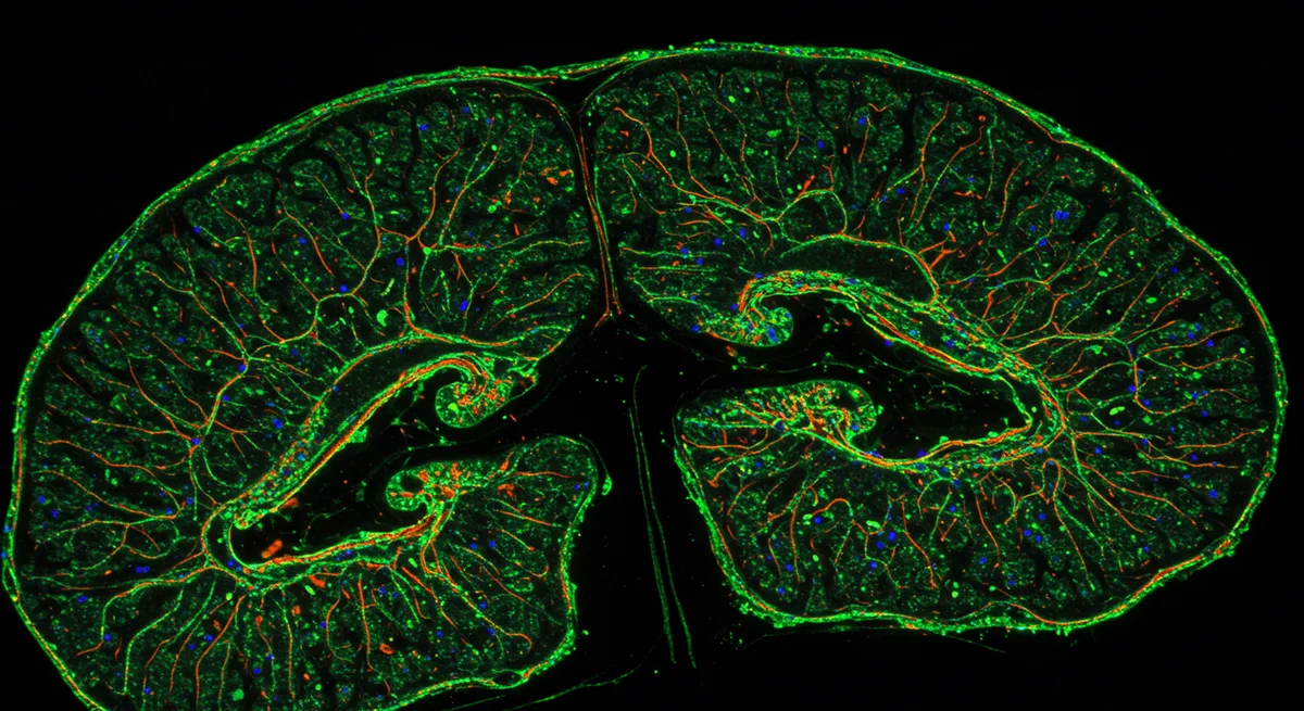 Parkinson’s Breakthrough: Why Mouse Models May Miss the Mark on LRRK2 Inflammation